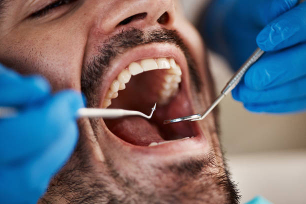 Best Emergency Dental Care for Broken or Chipped Teeth in Edwards, CO